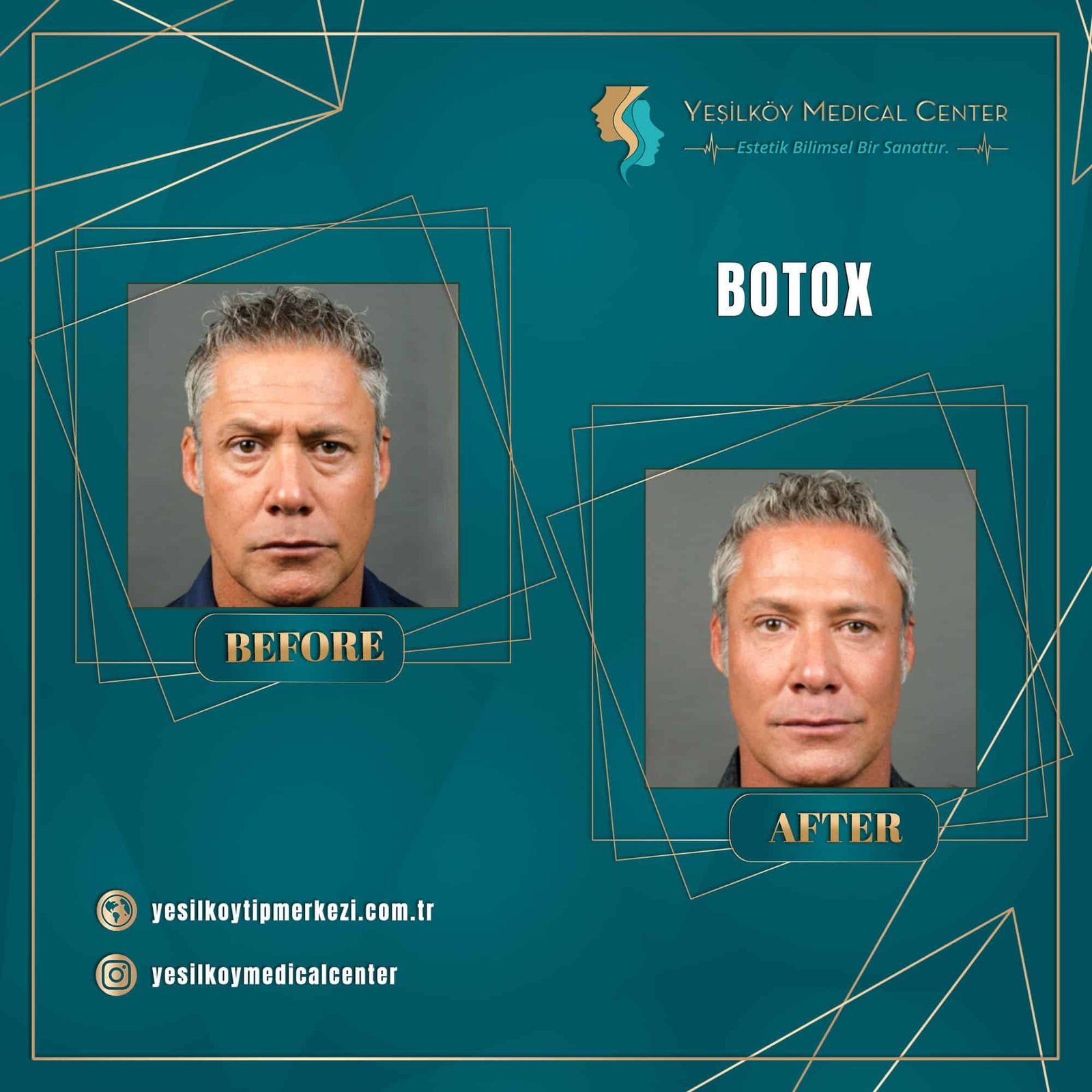 Medical Aesthetics consultation at Yesilkoy Clinic