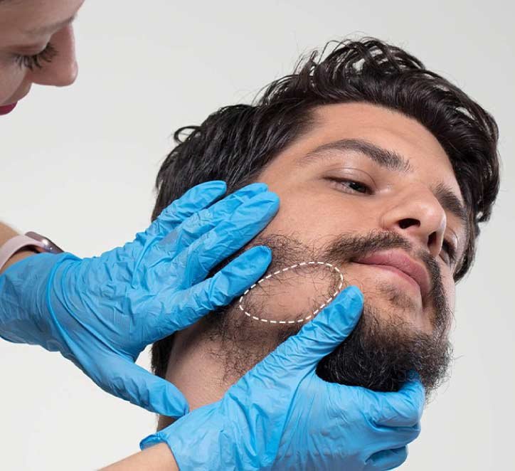 Beard transplant and hair transplant Turkey cost treatment options