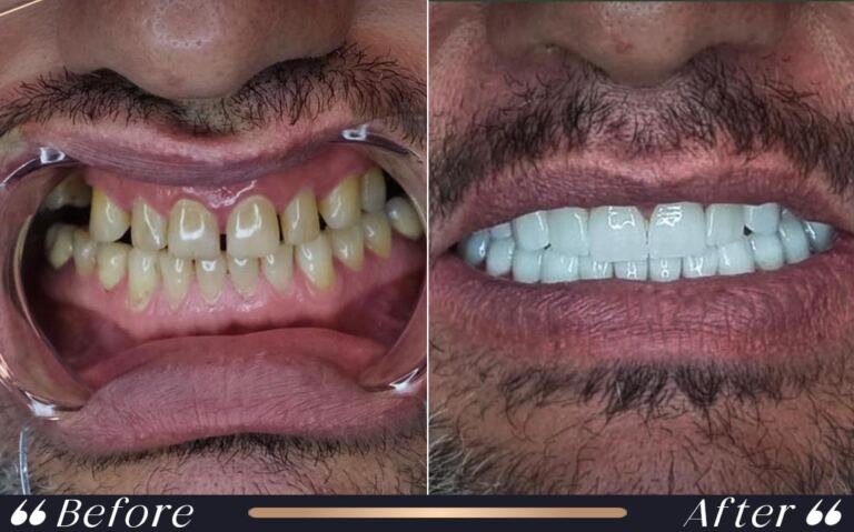 composite_3