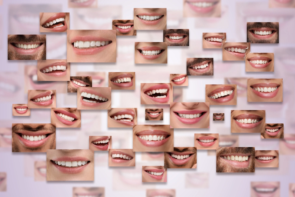 Dental Implants at Yesilkoy Clinic