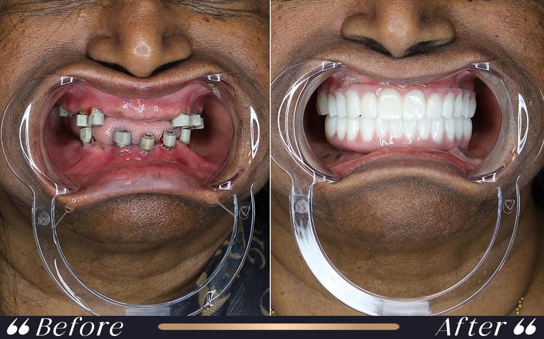 Dental Treatments consultation at Yesilkoy Clinic