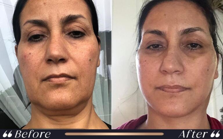 face_and_neck_12