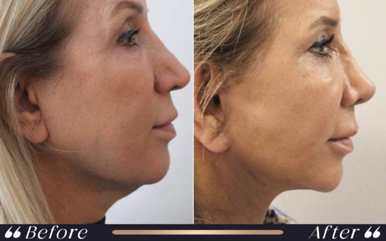 face_and_neck_2