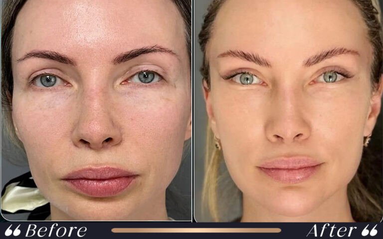 face_and_neck_21