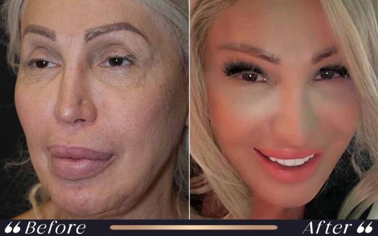 face_and_neck_22