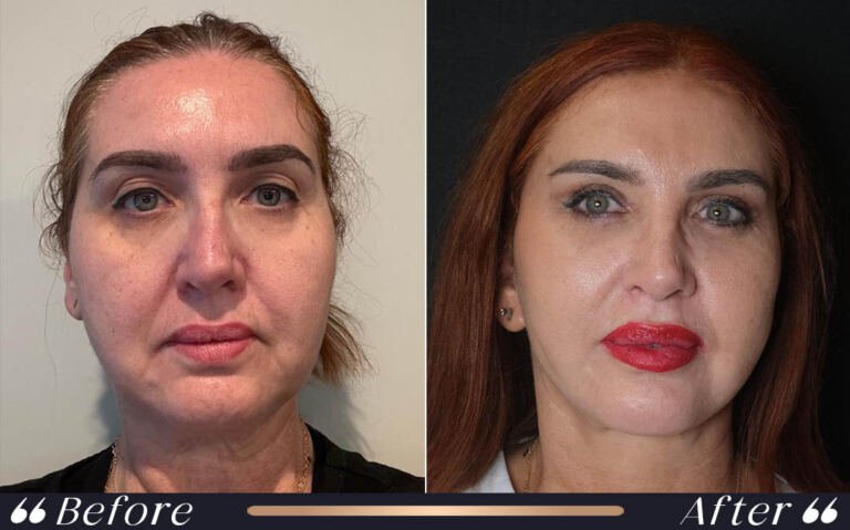 face_and_neck_26