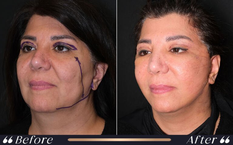 face_and_neck_3 (1)