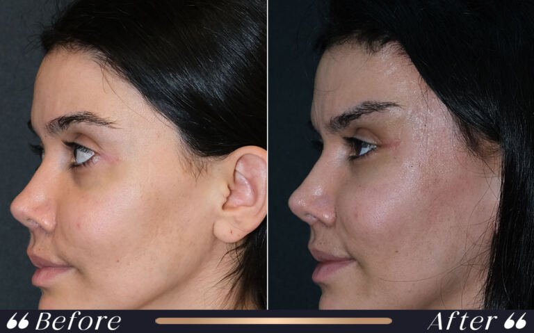face_and_neck_4 (1)