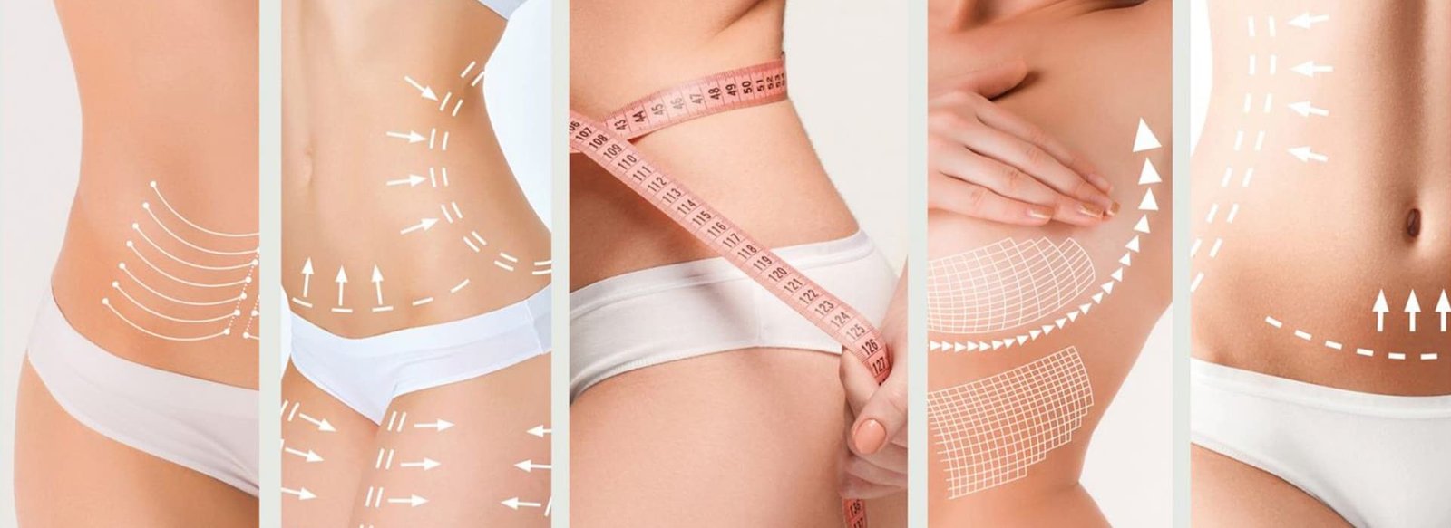 Plastic Surgery Consultation Turkey vs UK turkey vs uk plastic surgery professional medical consultation