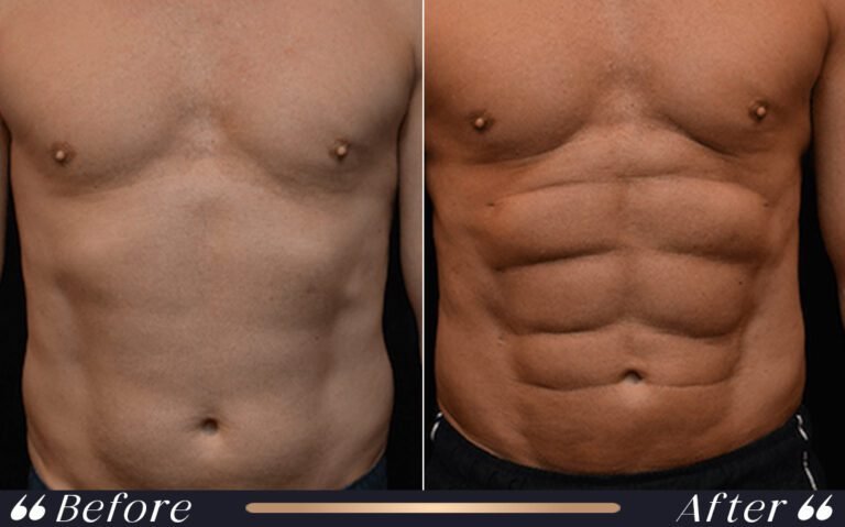 sixpack