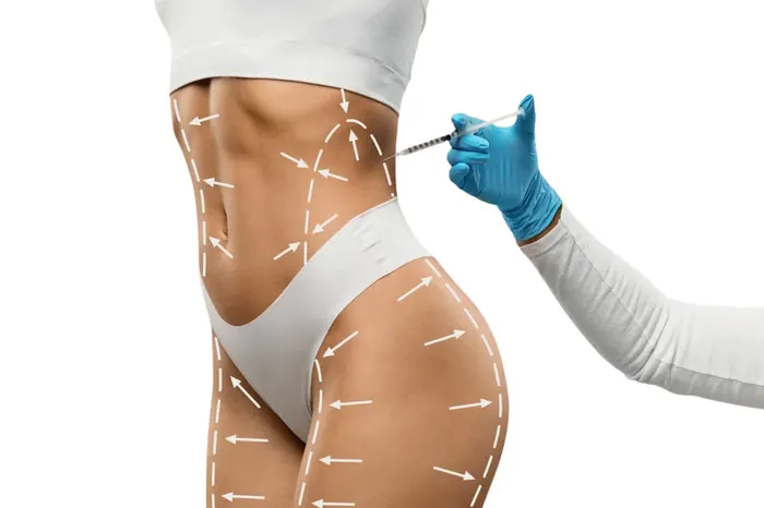 Body Aesthetics in Istanbul