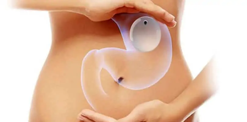 Gastric Balloon Treatment gastric balloon treatment in gastric balloon vs gastric sleeve comparison